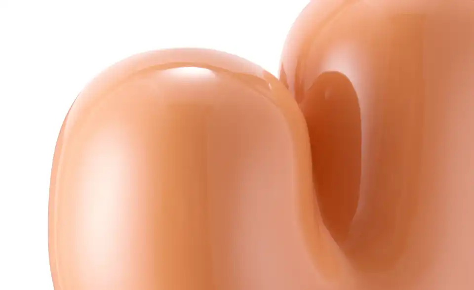 DONKEY Vase Sulcus, Detailansicht